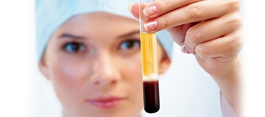 Saç PRP Tedavisi İzmir – Ödemiş