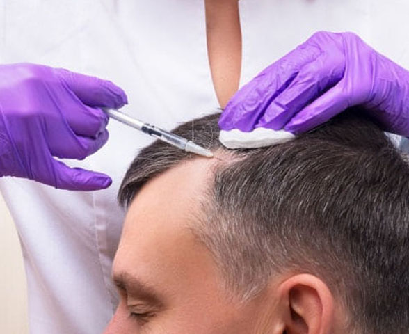 Saç PRP Tedavisi İzmir – Ödemiş
